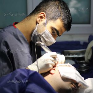 روش های کاشت مو