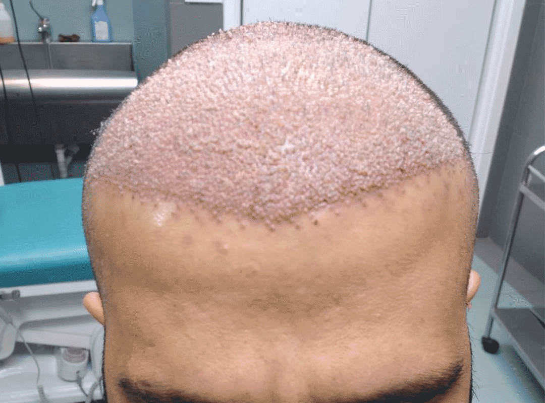 خدمات بوتاکس