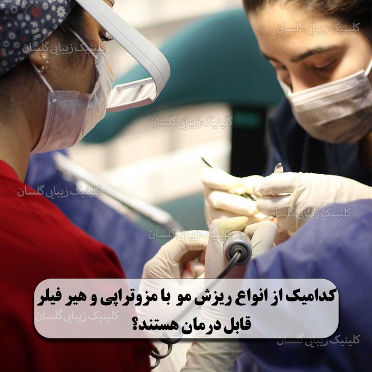 مزوتراپی و هیر فیلر