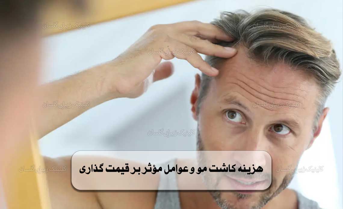 هزینه کاشت مو و عوامل مؤثر بر قیمت گذاری