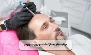 مراقبت‌های بعد از کاشت مو و روند بهبودی