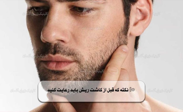 10 نکته که قبل از کاشت ریش باید رعایت کنید