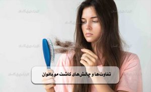 کاشت مو بانوان