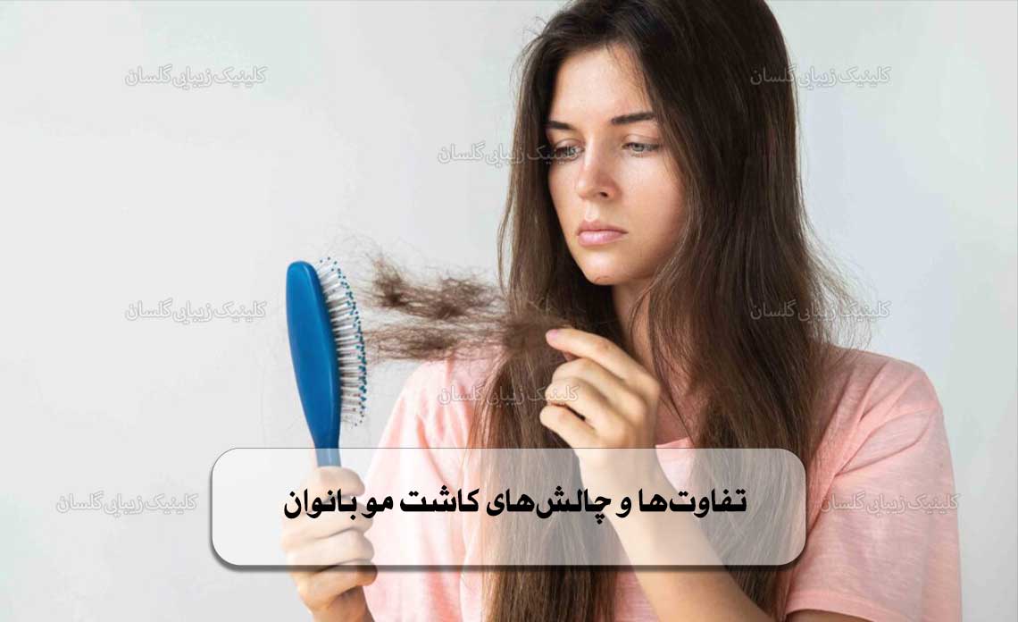 کاشت مو بانوان
