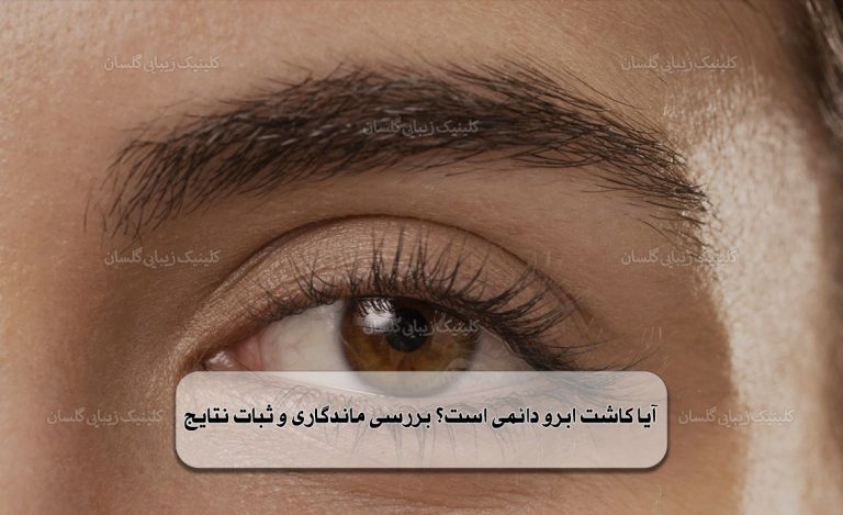 آیا کاشت ابرو دائمی است؟