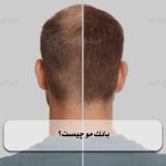 بانک مو چیست؟