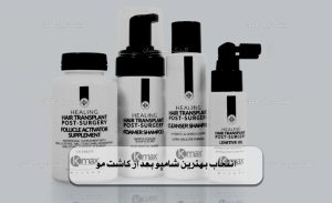 بهترین شامپو بعد از کاشت مو