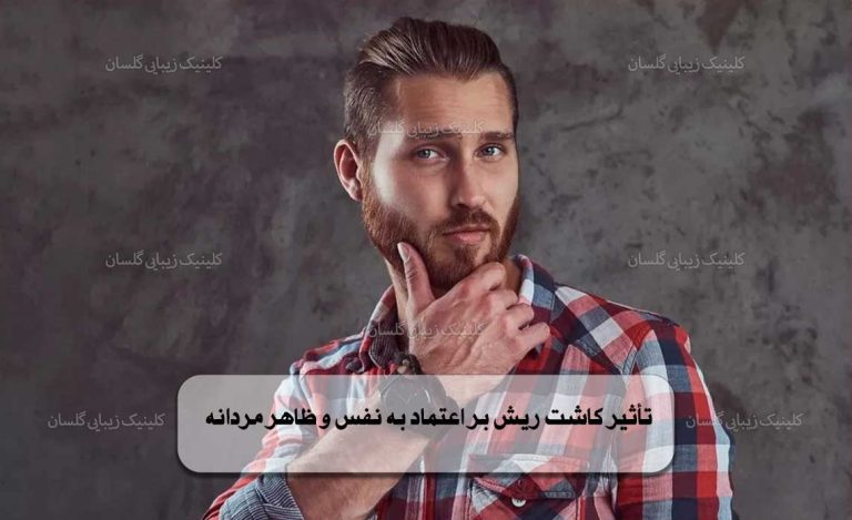تأثیر کاشت ریش بر اعتماد به نفس و ظاهر مردانه