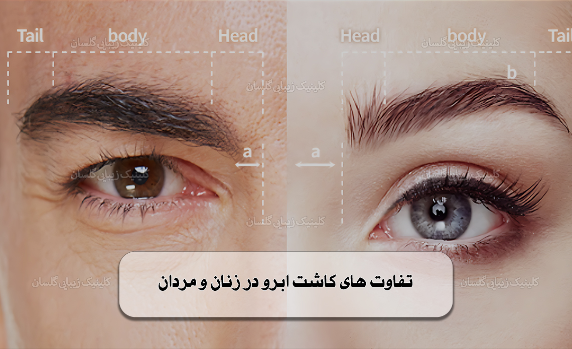 تفاوت‌ های کاشت ابرو در زنان و مردان