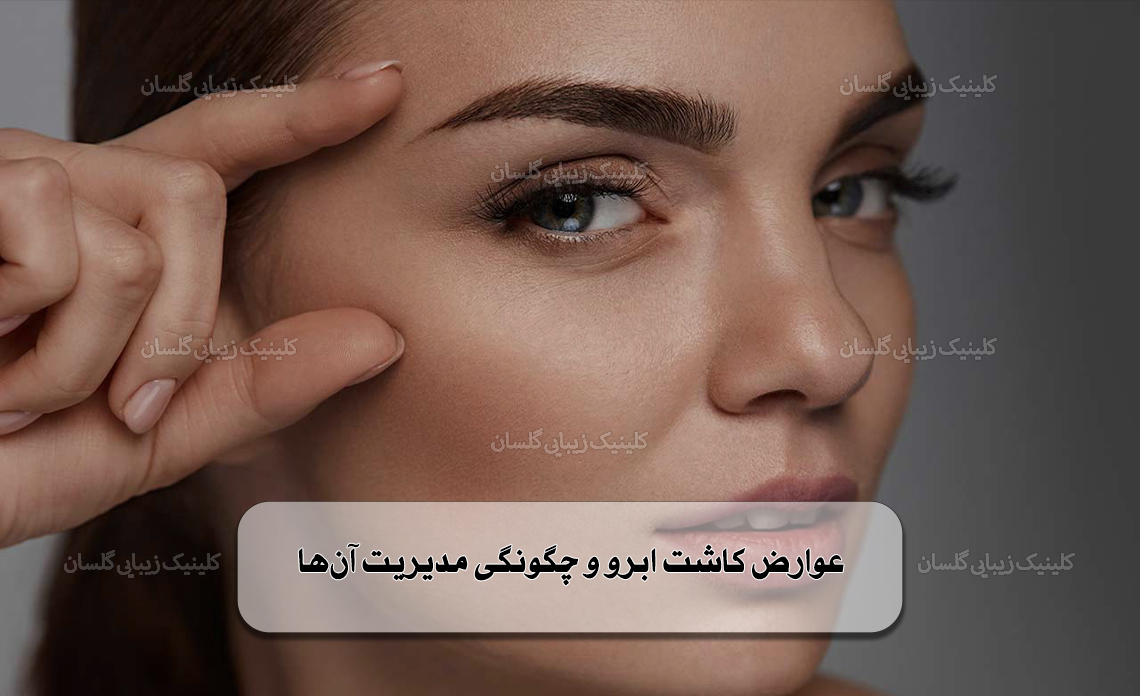 عوارض کاشت ابرو و چگونگی مدیریت آن‌ها