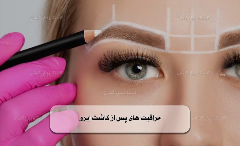 مراقبت‌ های پس از کاشت ابرو