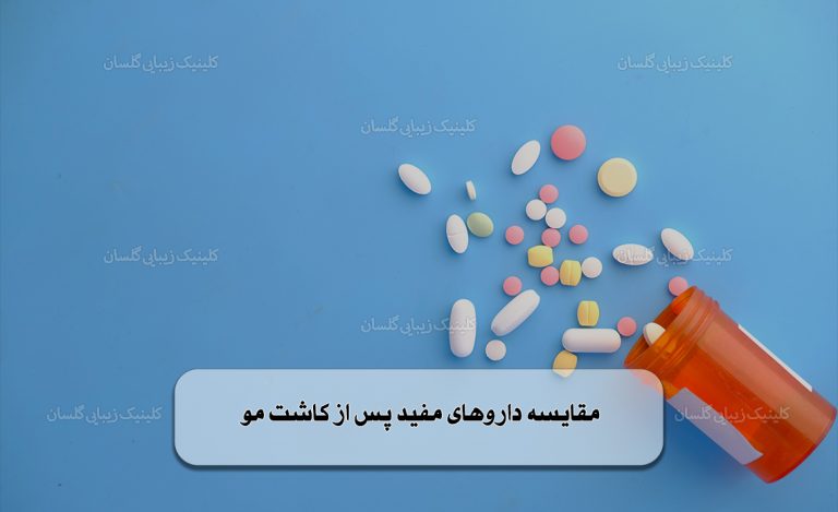 مقایسه داروهای مفید پس از کاشت مو