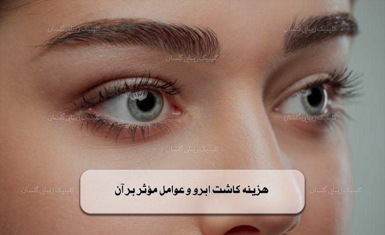 هزینه‌ کاشت ابرو و عوامل مؤثر بر آن